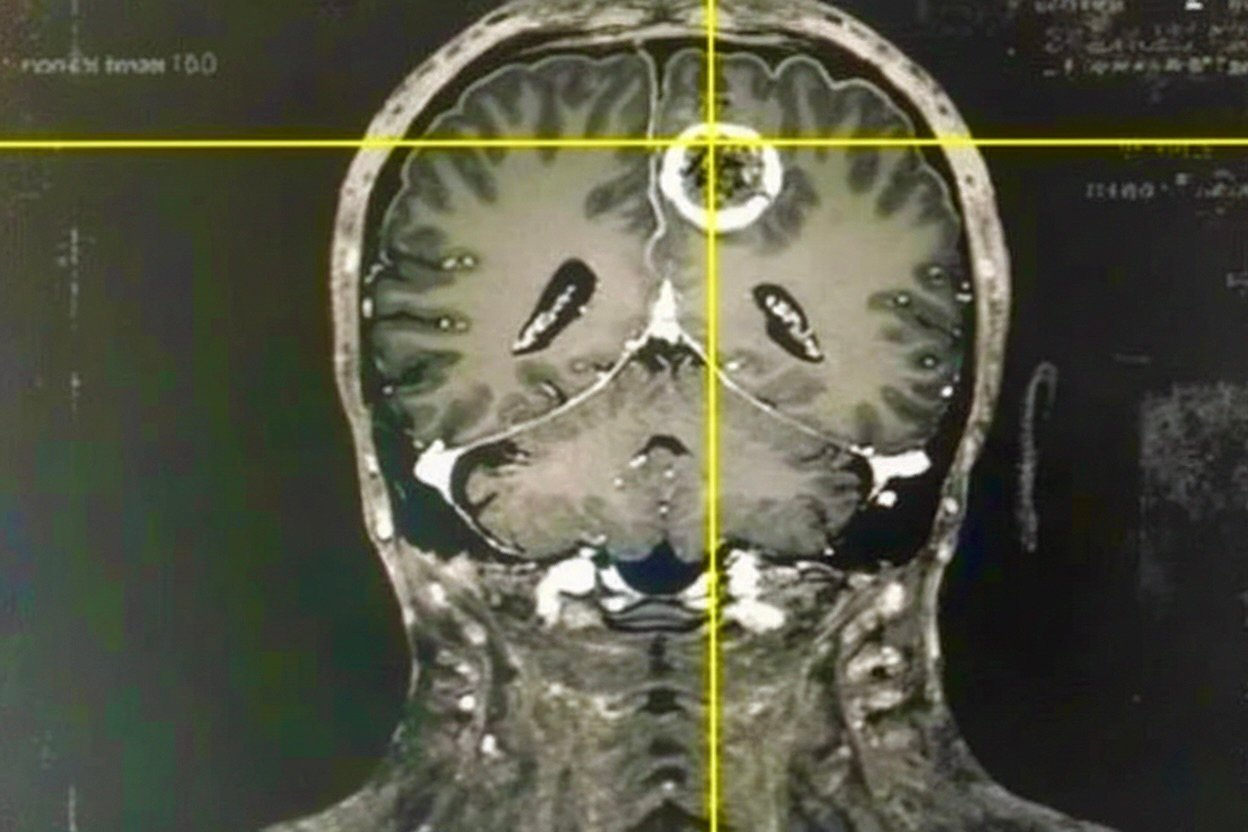 Agyi érrendszer felvétele — illusztráció